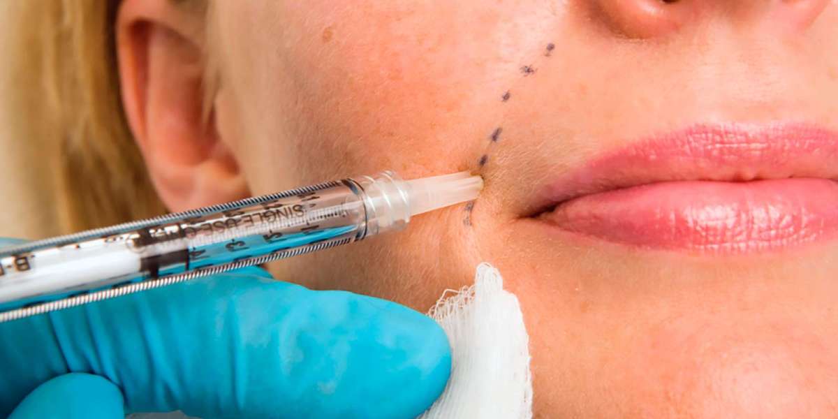 Dermal Fillers: The Non-Surgical Solution for Youthful, Rejuvenated Skin